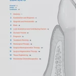 Periodontics The Complete Summary