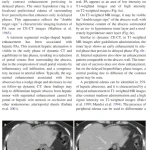 Sách Imaging of the Liver and Intra-hepatic Biliary Tract Volume 2